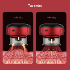 Máy giác hơi cạo gió điên tử không dây cầm tay